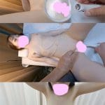 内科検診 吸引された乳首がのび過ぎてヤバいことになってる女性患者