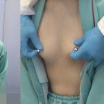 #66【同業種集結!!/診察】美人ぞろい!!美容クリニック看護師/歯科助手/羞恥敏感乳首診察